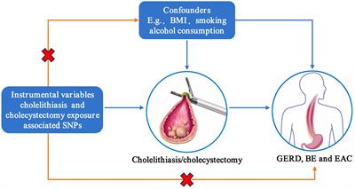 Cholelithiasis and cholecystectomy increase the risk of gastroesophageal reflux disease and Barrett’s esophagus